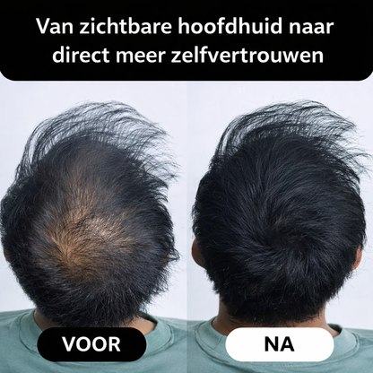 THICKR - Haarlijn Poeder